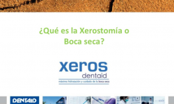 ¿Qué es la xerostomía o boca seca?
