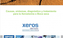 Causas, síntomas y tratamiento para la xerostomía
